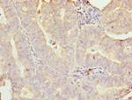 GALNT7 Polyclonal Antibody