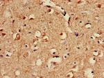 SPRED1 Antibody in Immunohistochemistry (Paraffin) (IHC (P))