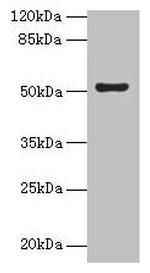 SLC46A3 Antibody in Western Blot (WB)