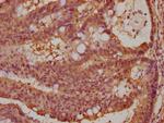ARPIN Antibody in Immunohistochemistry (Paraffin) (IHC (P))