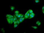 PNPLA5 Polyclonal Antibody