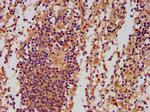 PNPLA5 Antibody in Immunohistochemistry (Paraffin) (IHC (P))