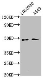 PNPLA5 Antibody in Western Blot (WB)