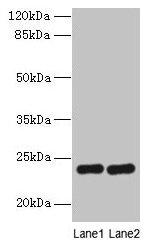 RD3 Antibody in Western Blot (WB)