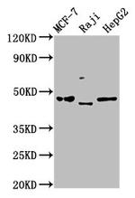 SERPINA11 Polyclonal Antibody