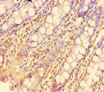 ZBTB46 Polyclonal Antibody