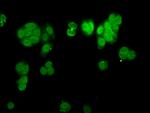 CHD1L Antibody in Immunocytochemistry (ICC/IF)