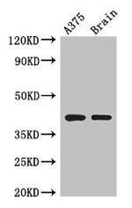 SEPT12 Antibody in Western Blot (WB)