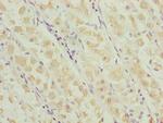 RNF135 Polyclonal Antibody