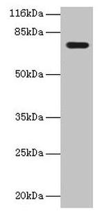 KBTBD2 Polyclonal Antibody