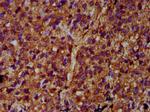 ULK2 Antibody in Immunohistochemistry (Paraffin) (IHC (P))