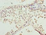 MMD2 Antibody in Immunohistochemistry (Paraffin) (IHC (P))