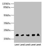 NRSN1 Antibody in Western Blot (WB)