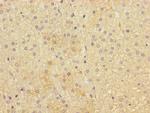IFNLR1 Antibody in Immunohistochemistry (Paraffin) (IHC (P))