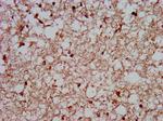 MKX Antibody in Immunohistochemistry (Paraffin) (IHC (P))