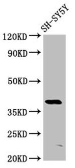 MKX Antibody in Western Blot (WB)