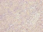 CEP57L1 Polyclonal Antibody