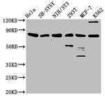 KMT2E Polyclonal Antibody