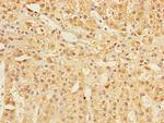 COMMD1 Polyclonal Antibody