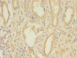 CCDC112 Antibody in Immunohistochemistry (Paraffin) (IHC (P))