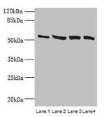 CCDC112 Antibody in Western Blot (WB)