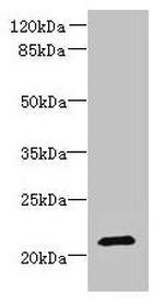 DYDC1 Polyclonal Antibody