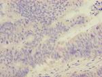 FOXRED1 Antibody in Immunohistochemistry (Paraffin) (IHC (P))