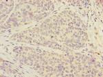 FOXRED1 Polyclonal Antibody