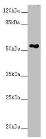 FOXRED1 Antibody in Western Blot (WB)