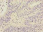 FOXRED1 Antibody in Immunohistochemistry (Paraffin) (IHC (P))