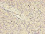 FOXRED1 Polyclonal Antibody