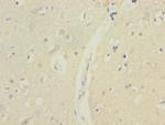 MTERFD1 Antibody in Immunohistochemistry (Paraffin) (IHC (P))