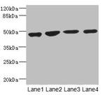 MTERFD1 Antibody in Western Blot (WB)