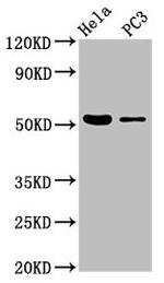 BRUNOL6 Polyclonal Antibody