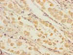 Pirh2 Polyclonal Antibody