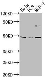 TMEM237 Antibody in Western Blot (WB)