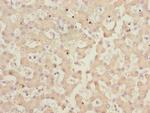IWS1 Polyclonal Antibody