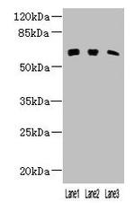 KLHL23 Polyclonal Antibody
