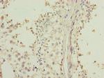 LRRC20 Antibody in Immunohistochemistry (Paraffin) (IHC (P))