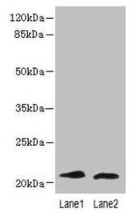 LRRC20 Antibody in Western Blot (WB)