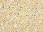 DIS3L Polyclonal Antibody