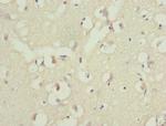 PPP2R1B Antibody in Immunohistochemistry (Paraffin) (IHC (P))