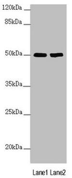 SLC39A7 Antibody in Western Blot (WB)