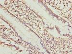 SGCD Polyclonal Antibody