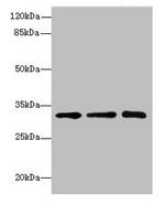 SGCD Antibody in Western Blot (WB)