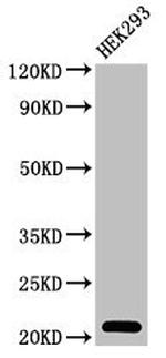 TSR2 Antibody in Western Blot (WB)