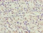 PPP2R3C Polyclonal Antibody