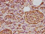 TID1 Antibody in Immunohistochemistry (Paraffin) (IHC (P))