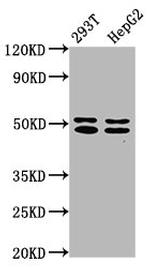 TRNT1 Polyclonal Antibody