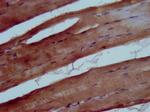 TRIB1 Antibody in Immunohistochemistry (Paraffin) (IHC (P))